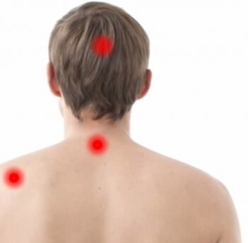 Foci of osteochondrosis